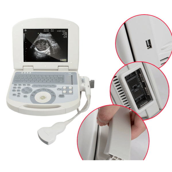 Escáner Ultrasonido Portátil Carejoy 2 Escáner Ultrasonido Portátil Carejoy - Image 2