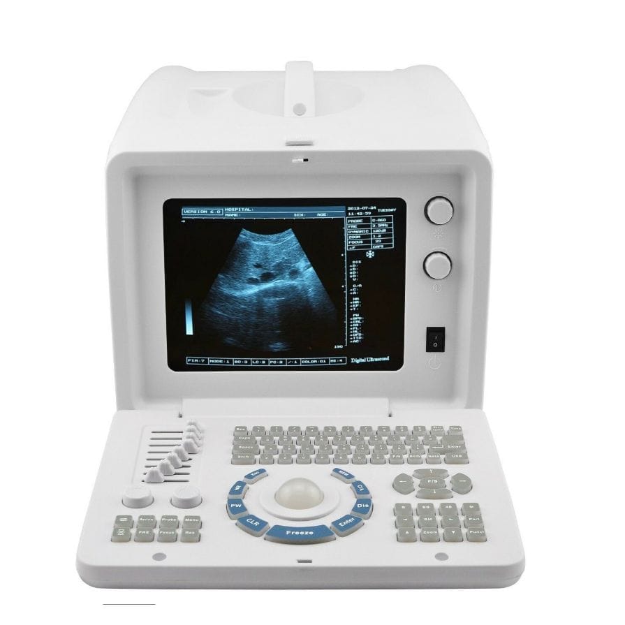 Escáner de ultrasonido digital portátil Carejoy 1 Escáner de ultrasonido digital portátil Carejoy